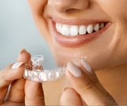 Invisalign Open House April 2018